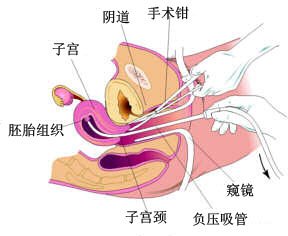  Ǯ